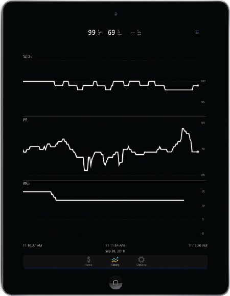 Ipad Display featuring wave readings for RRp, PR, and SpO2 