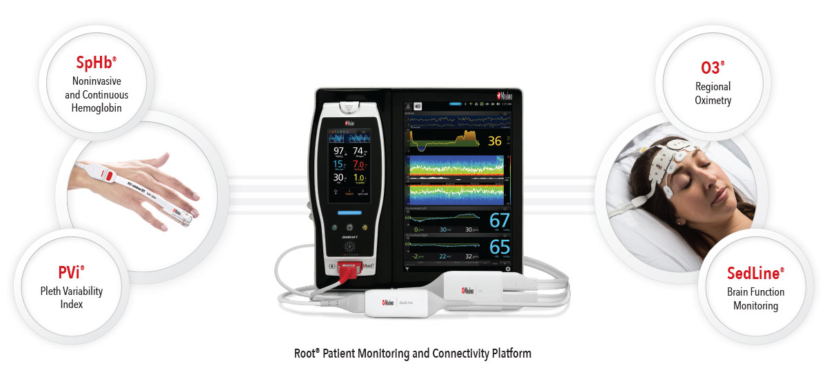 perioperative_monitoring_and_connectivity